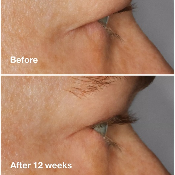 NIB NWT Clinique High Impact Lash Amplifying Serum For Longer & Darker Eyelashes - Picture 14 of 15